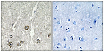 ACOT8 rabbit pAb Antibody