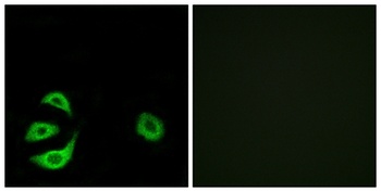 ACOT8 rabbit pAb Antibody