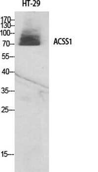 ACSS1 rabbit pAb Antibody
