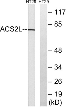 ACSS1 rabbit pAb Antibody