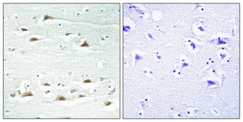 Actinin-α1/2/3/4 rabbit pAb