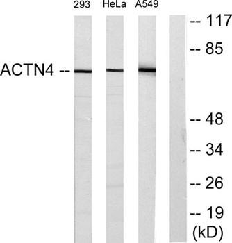 Actinin-α1/2/3/4 rabbit pAb