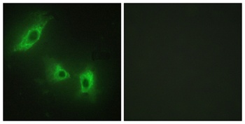 ACTR-IB rabbit pAb Antibody