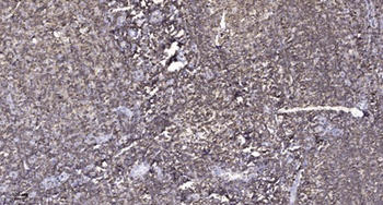 ACTR-IB rabbit pAb Antibody