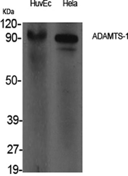 ADAMTS-1 rabbit pAb Antibody