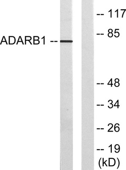 ADAR2 rabbit pAb Antibody