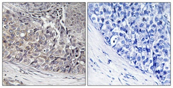 ADCK4 rabbit pAb Antibody
