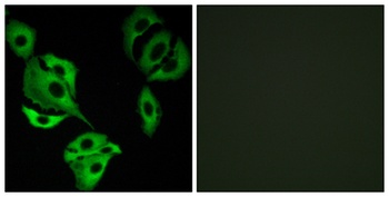 ADCK4 rabbit pAb Antibody