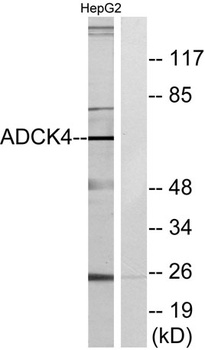ADCK4 rabbit pAb Antibody