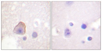 Adducin α/β rabbit pAb