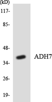 ADH7 rabbit pAb Antibody