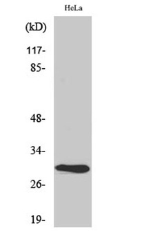 AI-BP rabbit pAb Antibody