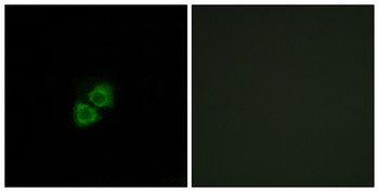 AI-BP rabbit pAb Antibody