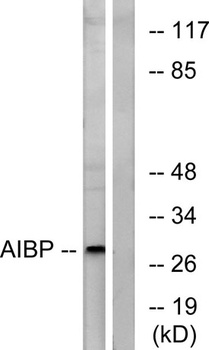 AI-BP rabbit pAb Antibody
