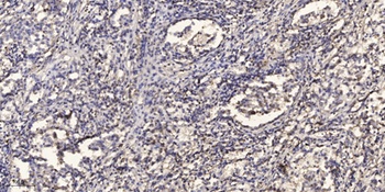 AIF-M1 rabbit pAb Antibody