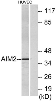 AIM2 rabbit pAb Antibody