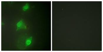 AIRE-1 rabbit pAb Antibody