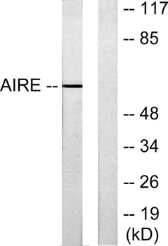 AIRE-1 rabbit pAb Antibody
