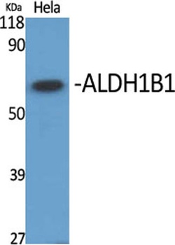 ALDH1B1 rabbit pAb Antibody
