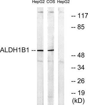 ALDH1B1 rabbit pAb Antibody