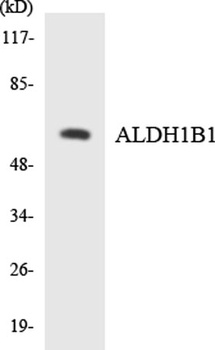 ALDH1B1 rabbit pAb Antibody