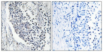 AMID rabbit pAb Antibody