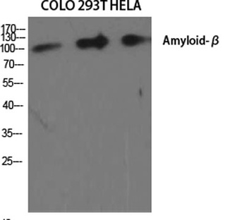Amyloid-β rabbit pAb Antibody