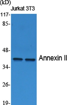 Annexin II rabbit pAb Antibody