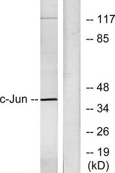 AP-1/Jun D rabbit pAb Antibody