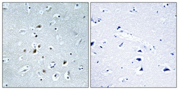 AP-2γ rabbit pAb Antibody