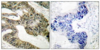 APC rabbit pAb Antibody