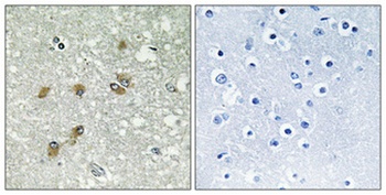 ApoL1 rabbit pAb Antibody