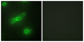 APRIL rabbit pAb Antibody