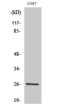 AQP2 rabbit pAb Antibody