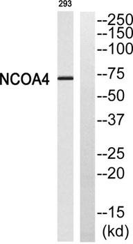 ARA70 rabbit pAb Antibody
