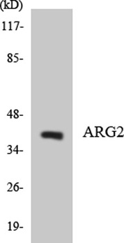 Arginase II rabbit pAb Antibody