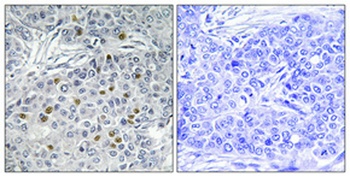 ARK-1 rabbit pAb Antibody