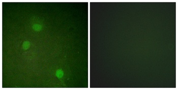 ARK-2 rabbit pAb Antibody