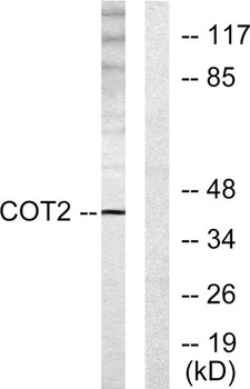 ARP-1 rabbit pAb Antibody