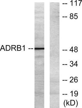 AR-β1 rabbit pAb Antibody