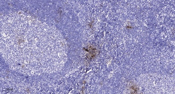 AR-β1 rabbit pAb Antibody