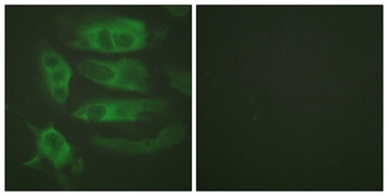 AR-β2 rabbit pAb Antibody