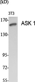 ASK 1 rabbit pAb Antibody