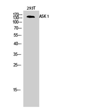 ASK 1 rabbit pAb Antibody