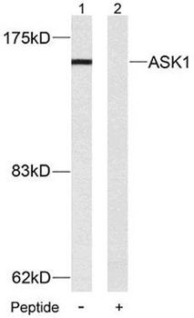 ASK 1 rabbit pAb Antibody