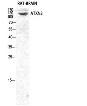Ataxin-2 rabbit pAb Antibody