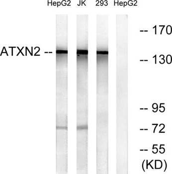 Ataxin-2 rabbit pAb Antibody