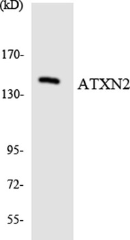 Ataxin-2 rabbit pAb Antibody
