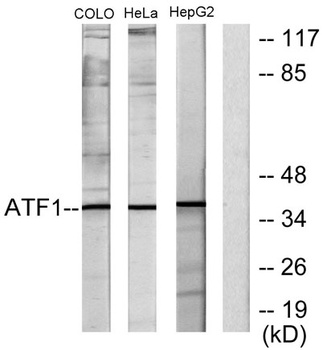 ATF-1 rabbit pAb Antibody