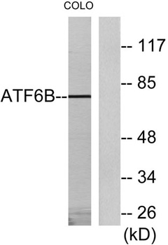 ATF-6β rabbit pAb Antibody